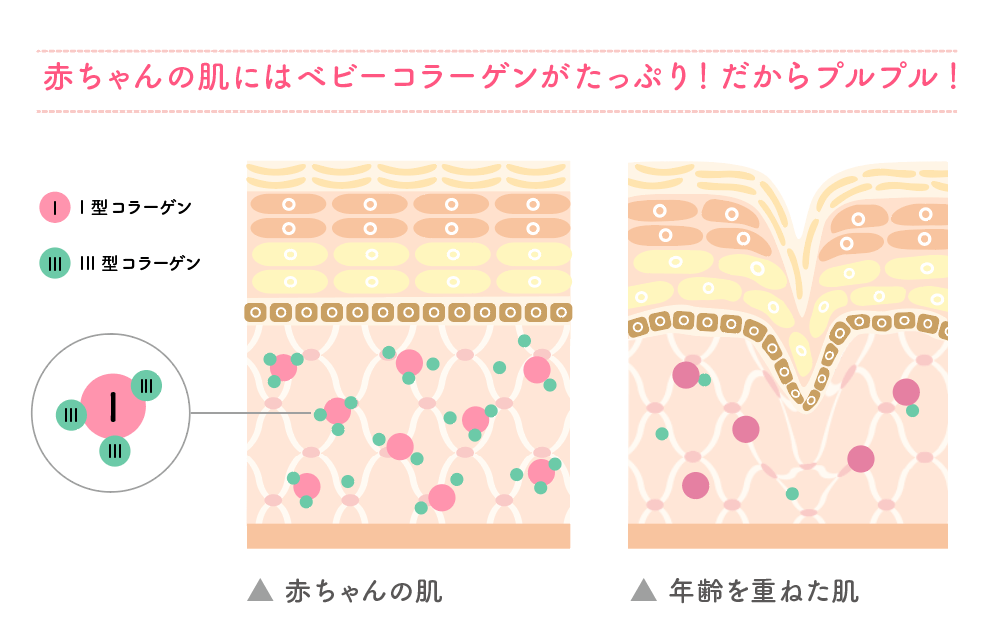 ベビーコラーゲン